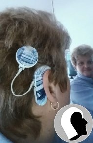 CI Kopf 2018 Erwachsen